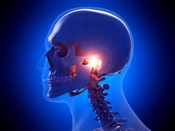 IMG TMJ pain AdobeStock 315096384
